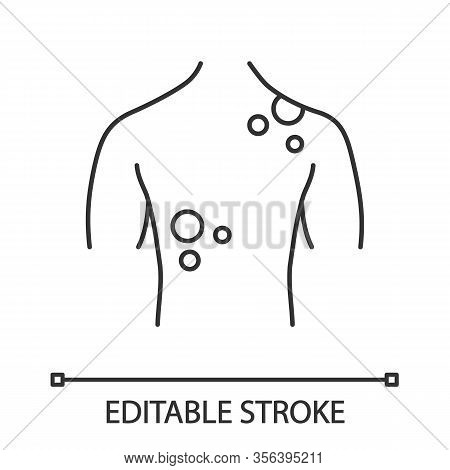 Skin Cancer Linear Icon. Thin Line Illustration. Dermatological Diseases. Rash, Spots On Back. Melan