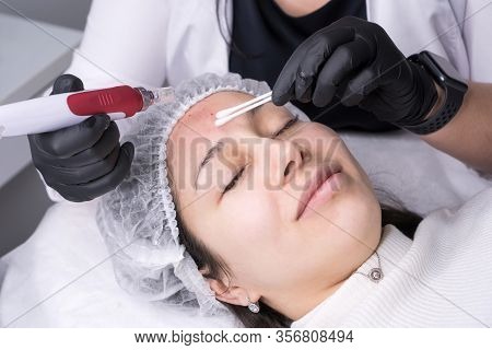 Cosmetologist Making Mesotherapy Injection. Microneedle Mesotherapy. Treatment Woman At Beautician. 