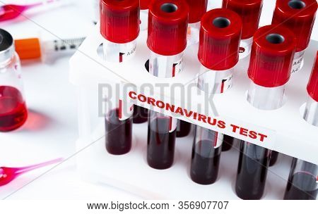 Coronavirus Blood Test Concept. Analyzing Blood Sample In Test Tube For Coronavirus Test. Test Tube