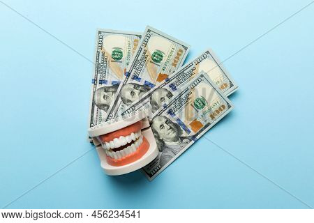 Closeup Model Of A Human Jaw With White Teeth And Dollar Bill. Dentistry Conceptual Photo. Prostheti
