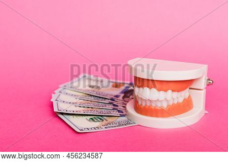 Closeup Model Of A Human Jaw With White Teeth And Dollar Bill. Dentistry Conceptual Photo. Prostheti