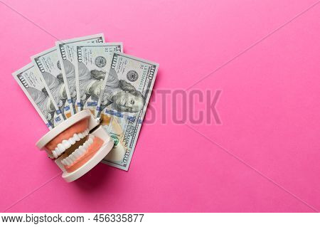 Closeup Model Of A Human Jaw With White Teeth And Dollar Bill. Dentistry Conceptual Photo. Prostheti