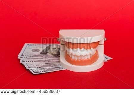 Closeup Model Of A Human Jaw With White Teeth And Dollar Bill. Dentistry Conceptual Photo. Prostheti