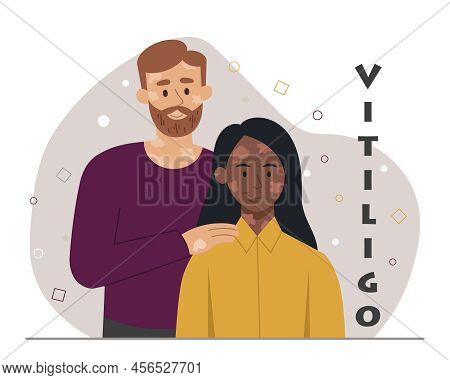 People With Skin Disease. Vitiligo And Health Problems, International Holiday And Medical Poster Or 
