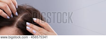 Close-up Of Woman With Thinning Hair On Head