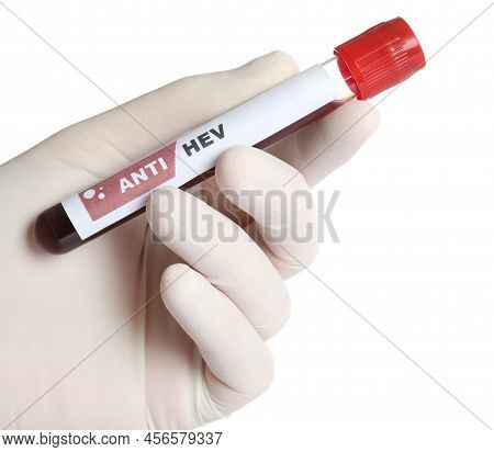 Scientist Holding Tube With Blood Sample And Label Anti Hev On White Background, Closeup