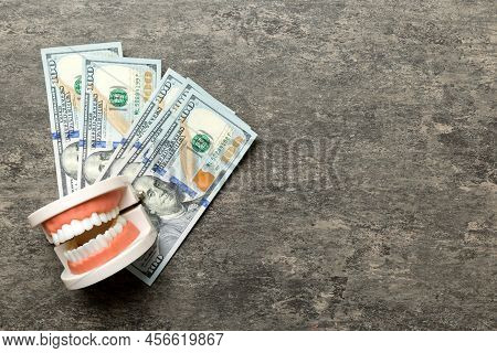 Closeup Model Of A Human Jaw With White Teeth And Dollar Bill. Dentistry Conceptual Photo. Prostheti