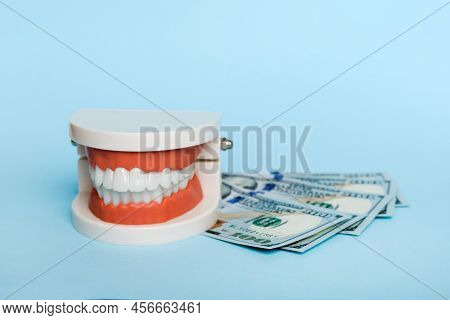Closeup Model Of A Human Jaw With White Teeth And Dollar Bill. Dentistry Conceptual Photo. Prostheti