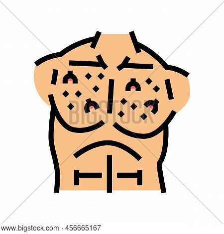 Chest Ingrown Hair Color Icon Vector. Chest Ingrown Hair Sign. Isolated Symbol Illustration
