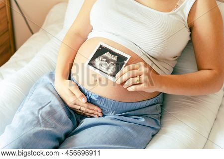 Ultrasound Image Pregnant Baby Photo. Woman Holding Ultrasound Pregnancy Picture. Pregnancy, Medicin
