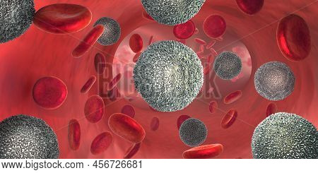 3d Illustration Of The Strong Increase Of Non-functional White Blood Cells Called Leukemia Cells Lea
