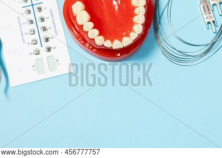 A Set Of Special Tools For An Orthodontist To Install Braces For A Patient. Orthodontic Arcs, Ligatu