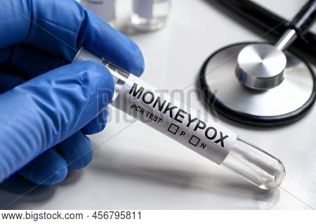 Monkeypox Pcr Test Tube In Doctors Hand, Medical Kit For Monkey Pox Virus Diagnostics And Smallpox R