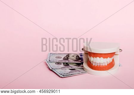 Closeup Model Of A Human Jaw With White Teeth And Dollar Bill. Dentistry Conceptual Photo. Prostheti