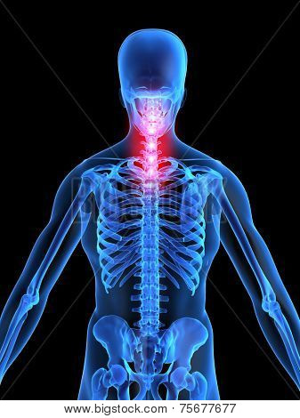 backache illustration