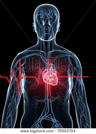 heartbeat/heartattack