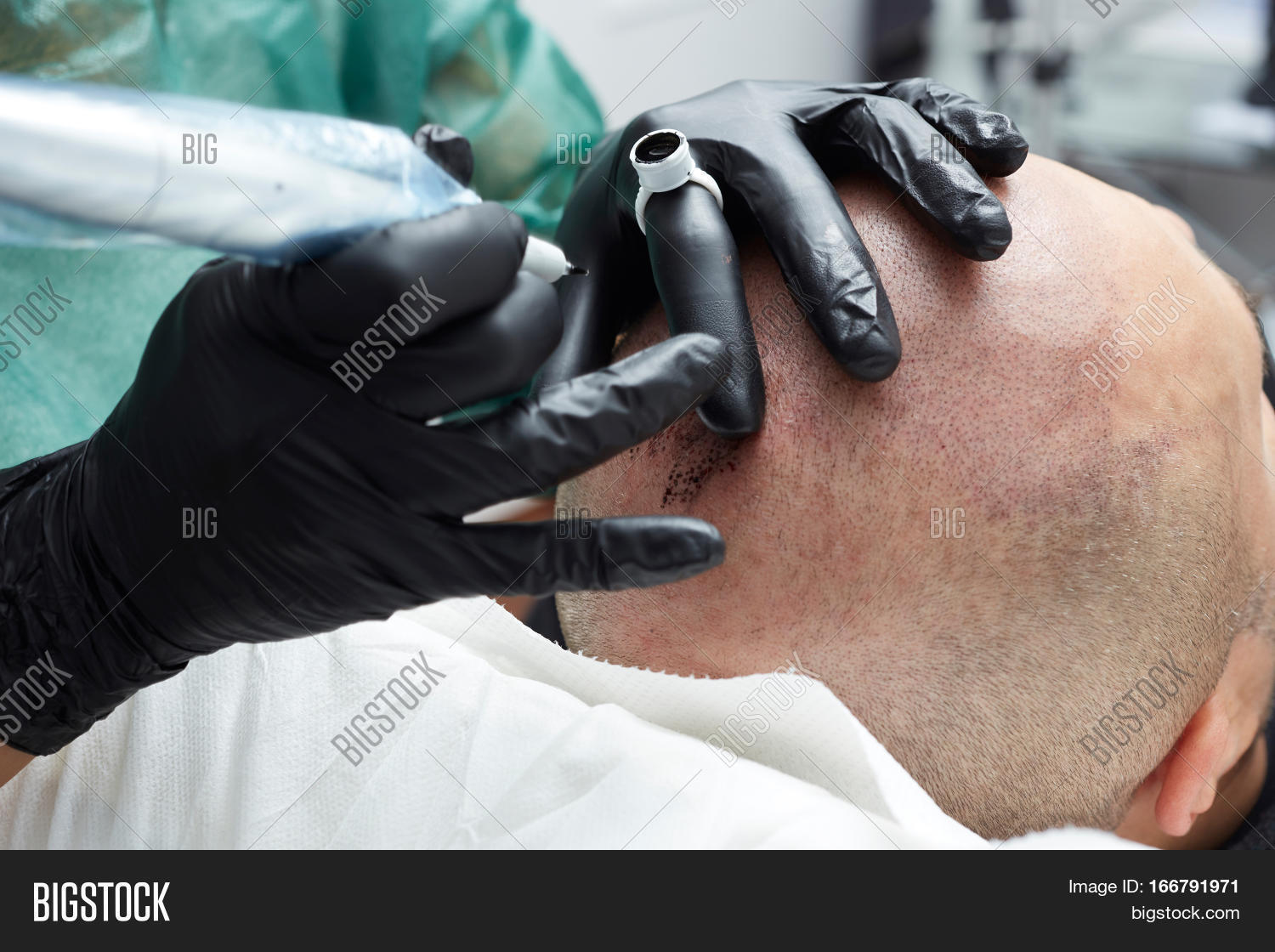 Image Preview