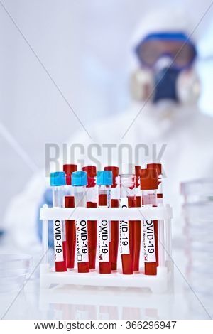 COVID-19. Doctor, microbiologist, scientist in a protective suit, makes a research on blood samples of infected people in the laboratory. Coronavirus test.
