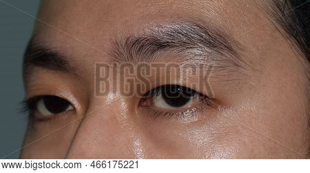Southeast Asian, Chinese Young Man With Single Eyelid Or Monolid. A Monolid Means That There Is No V
