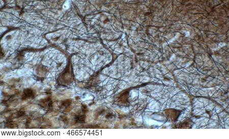 The Cerebellar Cortex Is Divided Into Three Layers. At The Bottom Lies The Thick Granular Layer, Den