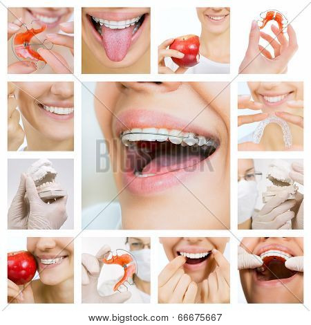 Dental Care Collage (dental Services)