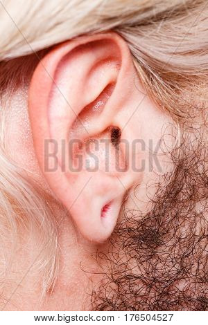 Stretched Man Ear After Tunnel Piercing
