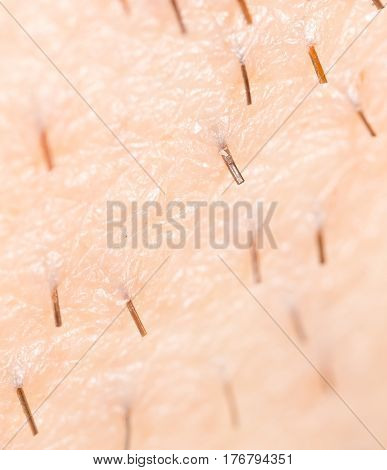 the bristles on the skin . Photo texture