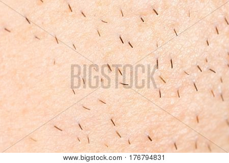 the bristles on the skin . Photo texture