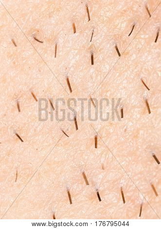 the bristles on the skin . Photo texture