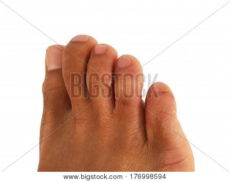 Foot and toes of most  Asian men