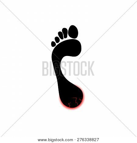 Symbol Of Human Foot With Painful Red Cracks On Heel. Vector Object Isolated On White Background.