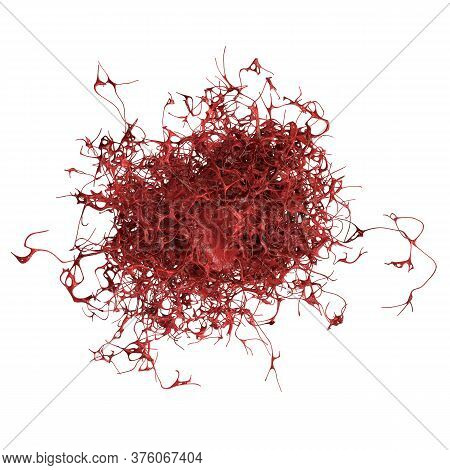 Cancer Cell, Malignant Tumor Cell, 3d Illustration
