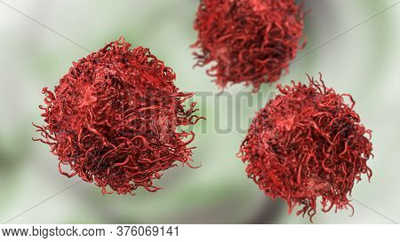 Stomach Cancer Cells, 3d Illustration Showing Morphology Of Cancerous Cells