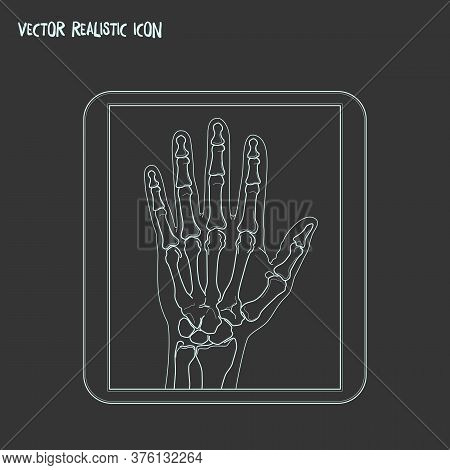 Radiography Icon Line Element. Vector Illustration Of Radiography Icon Line Isolated On Clean Backgr