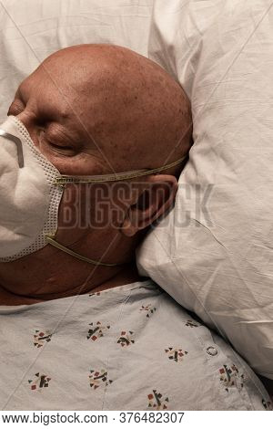 Head Of A Man Wearing A Respirator In A Hospital Bed, Bald Cancer Chemotherapy, Sick And Dying, Vert