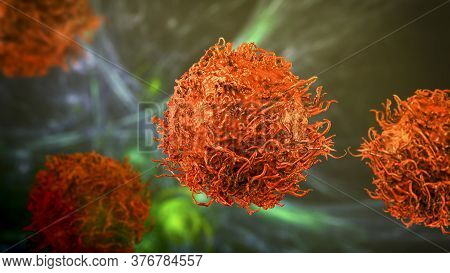 Stomach Cancer Cells, 3d Illustration Showing Morphology Of Cancerous Cells