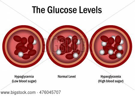 Blood Glucose Levels. Normal Level, Hyperglycemia And Hypoglycemia, 3d Rendering