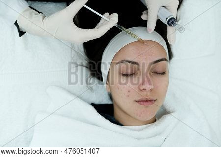 Cosmetologist Applying Face Serum, Preparing Skin For Microneedling