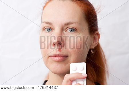 Portrait Of Middle Aged Woman With Herpes Above Upper Lip, On Light Background. Woman Holding Pills 