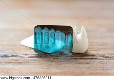 Teeth X-ray And A Large White Tooth Model Placed On A Wooden Background. Dental Health, Oral Hygiene