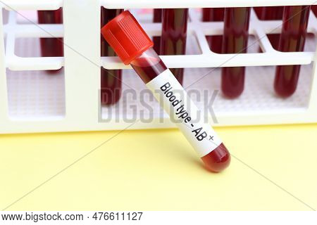 Blood Type Ab Rh Positive Test, Blood Sample To Analyze In The Laboratory, Blood In Test Tube