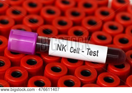 Nk Cell Test, Blood Sample To Analyze In The Laboratory, Blood In Test Tube