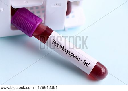 Thrombocytosis Test, Blood Sample To Analyze In The Laboratory, Blood In Test Tube