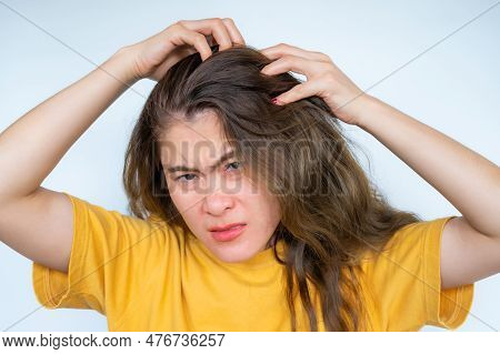Asian Woman Scratching Her Scalp Caused Of Itchy Scalp. Dandruff And An Inflammatory Skin Condition 
