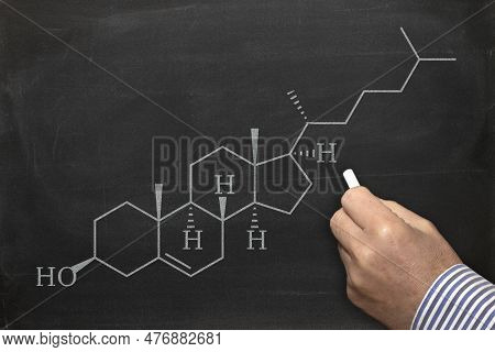 Cholesterol Structural Chemical Formula, Hand Drawing With A Chalk On A Blackboard, School Chemistry
