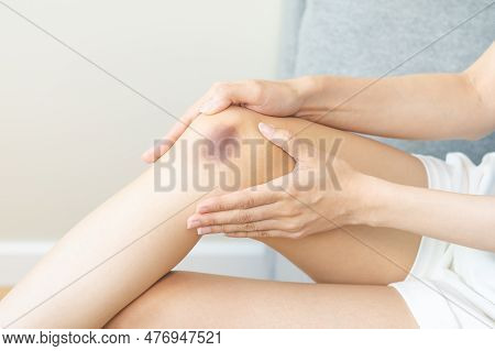 Close Up Of Stain Bruise Wound On Leg, Contusion Asian Young Woman, Girl On Joint Knee From An Accid