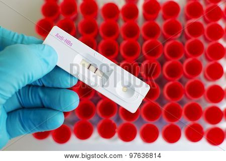 Anti-HBs positive