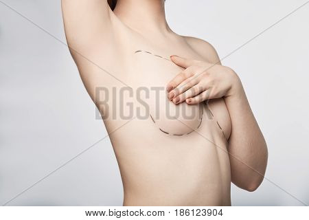 Surgery dotted line on body with marker breast