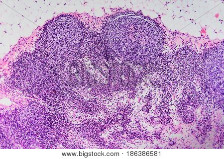 Lymph Node Dog