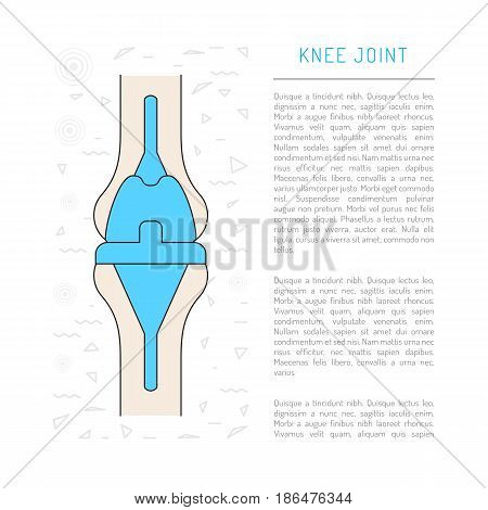 Treatment and prosthetics of the knee joint, Medical illustration in vector isolated on white background
